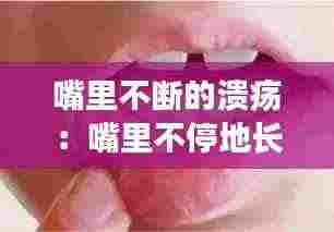 嘴里不断的溃疡:嘴里不停地长溃疡