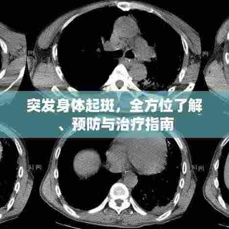 突发身体起斑,全方位了解、预防与治疗指南